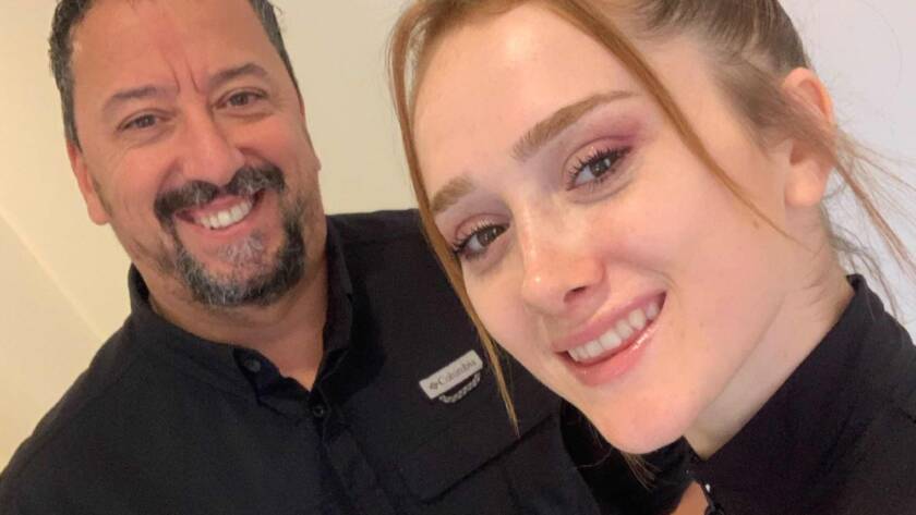 burun estetiği yaptıranlar