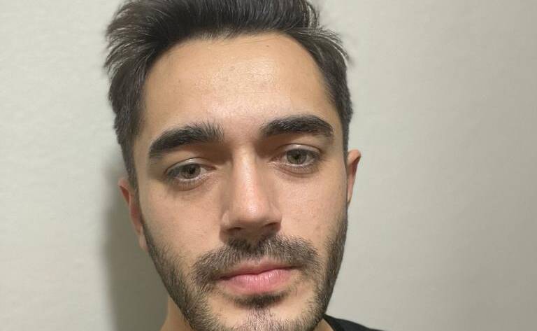 burun estetiği yaptıranlar