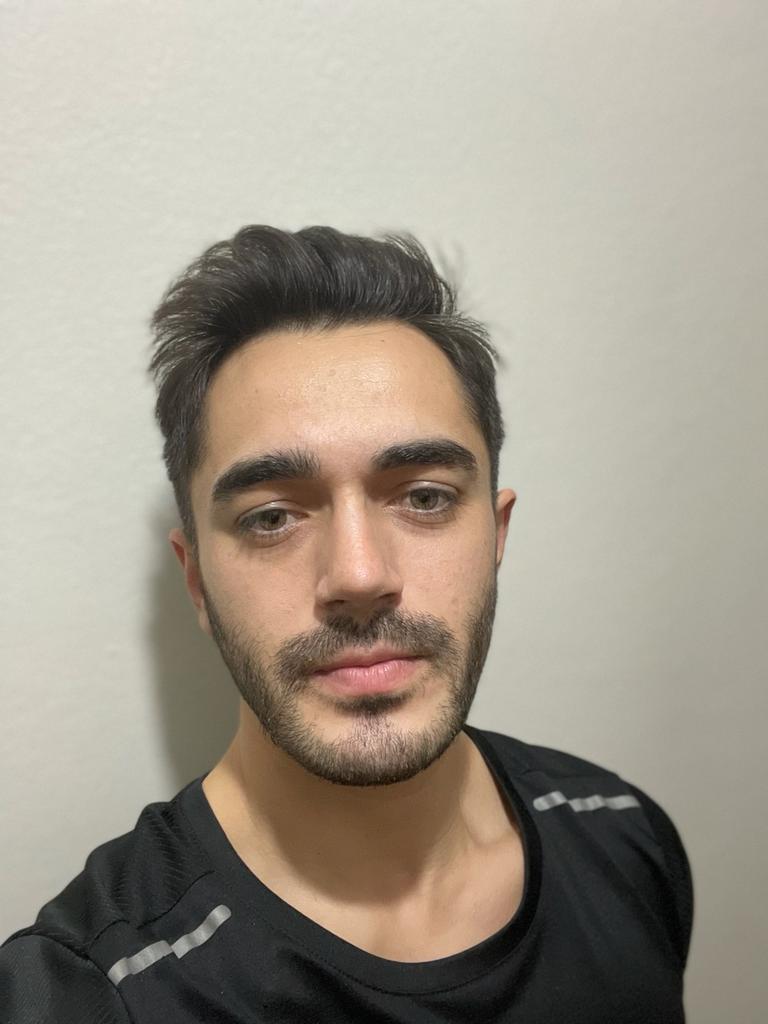 burun estetiği yaptıranlar burun estetiği