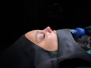 Frequently Asked Questions in Rhinoplasty